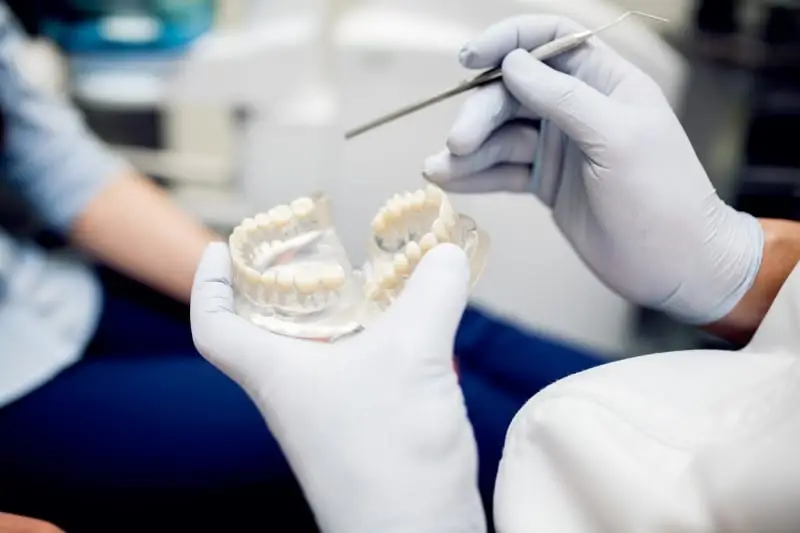 showing dental imprint for implants at Practice Tepper