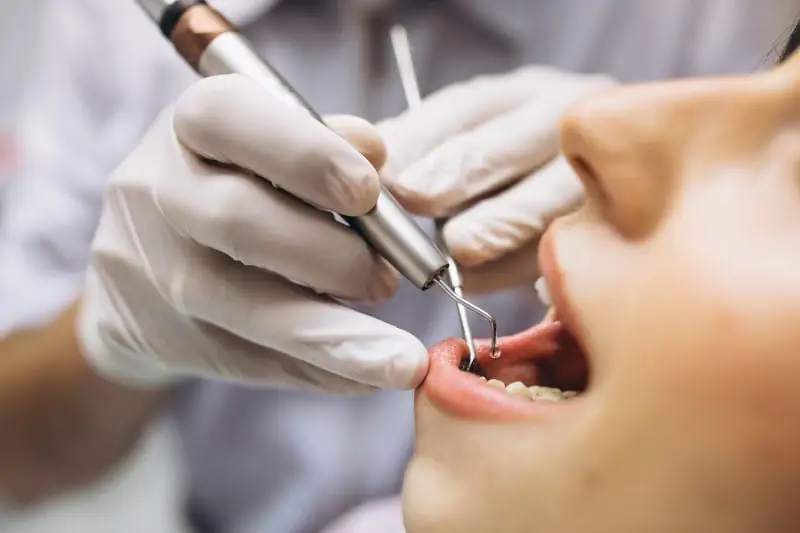 Woman patient at dentist with open mouth - Practice Tepper